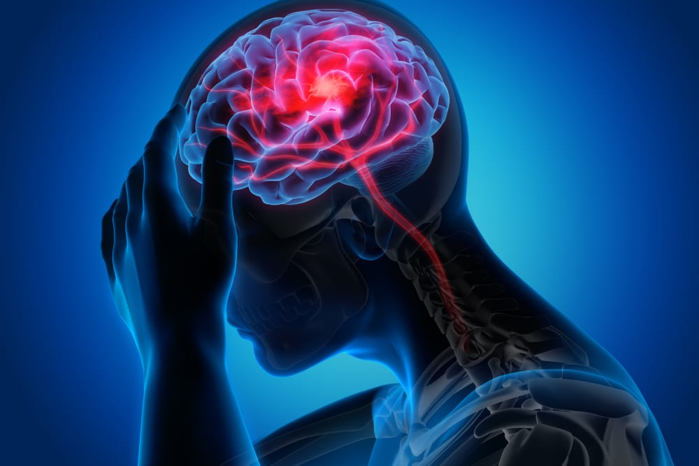 Warunki, które najczęściej leczą neurolodzy