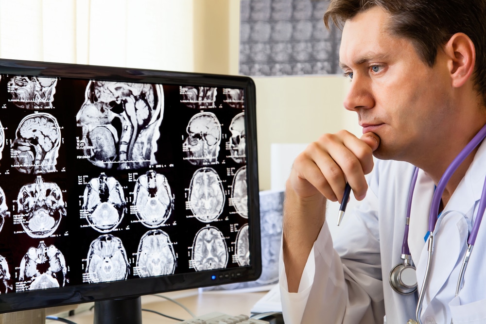 What Is a Traumatic Brain Injury